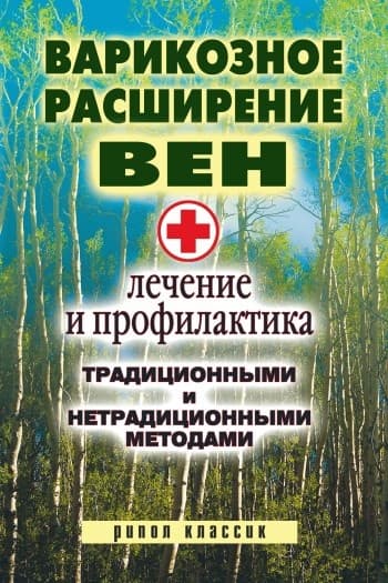 Варикозное расширение вен. Лечение и профилактика традиционными и нетрадиционными методами